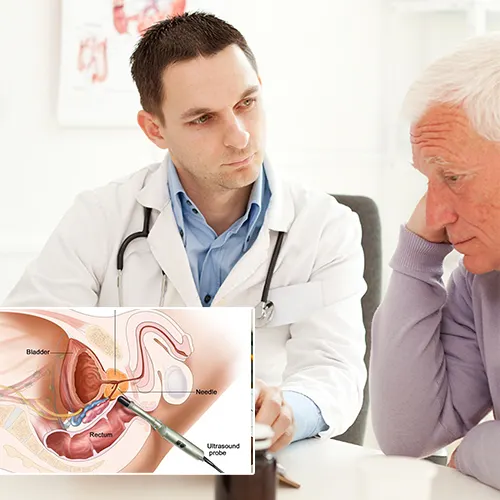 Innovations in Penile Implant Technology